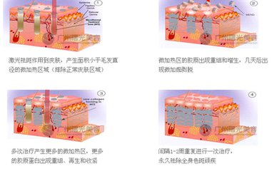 哪種方式去老年斑好?