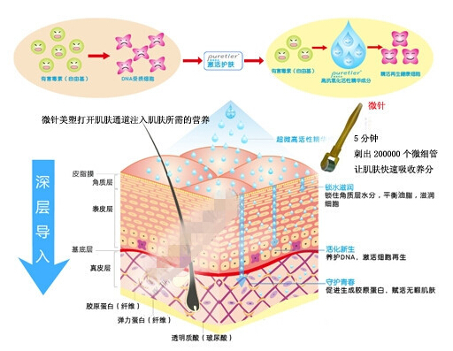 美塑去痘印有哪些優(yōu)勢?