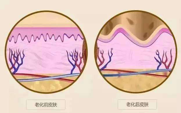 武漢電波拉皮除皺的效果怎么樣