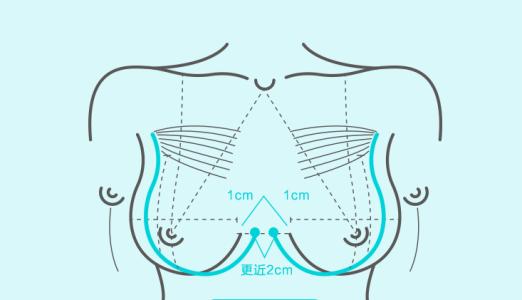 武漢隆胸失敗修復(fù)要注意什么