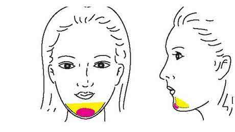 武漢豐下巴有什么方式