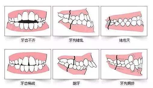 武漢牙齒矯正需要多久